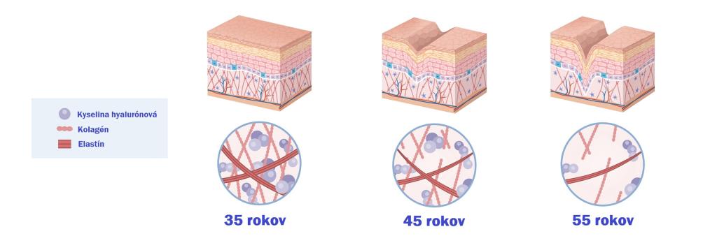 Kolagén, kyselina hyalurónová a elastín vekom klesajú